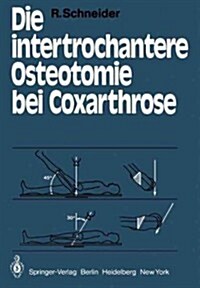 Die Intertrochantere Osteotomie Bei Coxarthrose (Paperback, Softcover Repri)