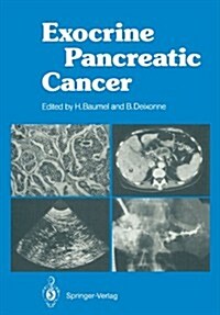 Exocrine Pancreatic Cancer (Paperback, Softcover Repri)