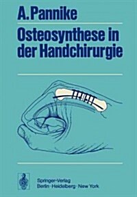 Osteosynthese in Der Handchirurgie (Paperback, Softcover Repri)
