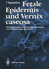 Fetale Epidermis Und Vernix Caseosa: Reifungsprozesse Am Schwangerschaftsende Und Initiativprozesse Der Geburt (Paperback)