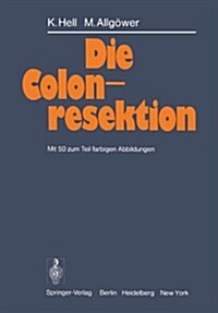 Die Colonresektion (Paperback, Softcover Repri)