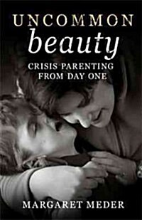 Uncommon Beauty: Crisis Parenting from Day One (Paperback)