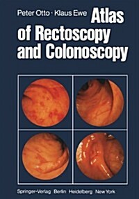 Atlas of Rectoscopy and Coloscopy (Paperback, Softcover Repri)