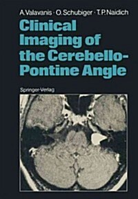Clinical Imaging of the Cerebello-Pontine Angle (Paperback, Softcover Repri)