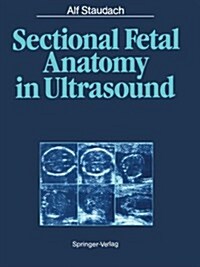 Sectional Fetal Anatomy in Ultrasound (Paperback, Softcover Repri)