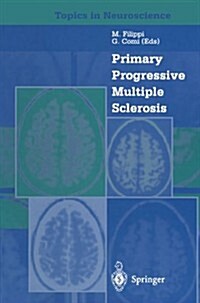 Primary Progressive Multiple Sclerosis (Paperback, Softcover Repri)