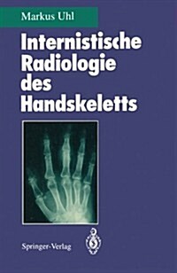 Internistische Radiologie Des Handskeletts (Paperback)