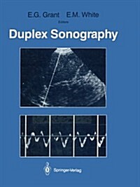 Duplex Sonography (Paperback, Softcover Repri)