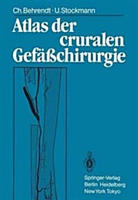 Atlas Der Cruralen Gef癌chirurgie (Paperback)