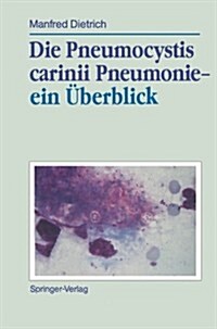 Die Pneumocystis Carinii Pneumonie-- Ein ?erblick (Paperback)