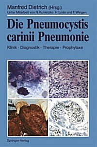 Die Pneumocystis Carinii Pneumonie: Klinik - Diagnostik - Therapie - Prophylaxe (Paperback)