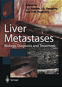 Liver Metastases : Biology, Diagnosis and Treatment (Paperback, Softcover reprint of the original 1st ed. 1998)