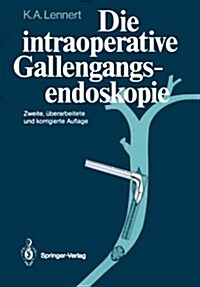 Die Intraoperative Gallengangsendoskopie (Paperback, 2nd, Reprint)