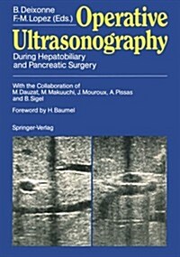 Operative Ultrasonography: During Hepatobiliary and Pancreatic Surgery (Paperback, Softcover Repri)