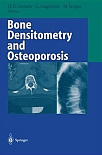 Bone Densitometry and Osteoporosis (Paperback, Softcover Repri)