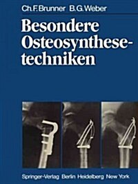 Besondere Osteosynthesetechniken (Paperback, Softcover Repri)