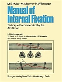 Manual of Internal Fixation: Technique Recommended by the Ao-Group Swiss Association for the Study of Internal Fixation: Asif (Paperback, Softcover Repri)