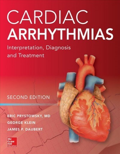 Cardiac Arrhythmias: Interpretation, Diagnosis and Treatment, Second Edition (Hardcover, 2)