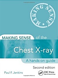 Making Sense of the Chest X-ray : A hands-on guide (Paperback, 2 ed)