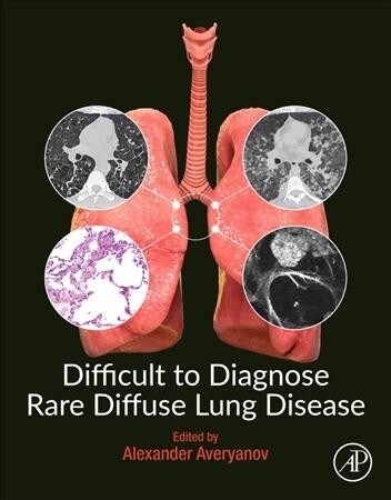 Difficult to Diagnose Rare Diffuse Lung Disease (Paperback)