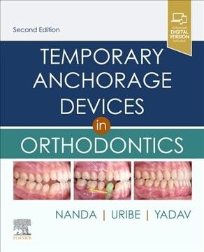 Temporary Anchorage Devices in Orthodontics (Hardcover, 2)