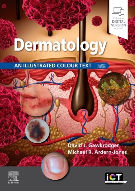 Dermatology : An Illustrated Colour Text (Paperback, 7 ed)