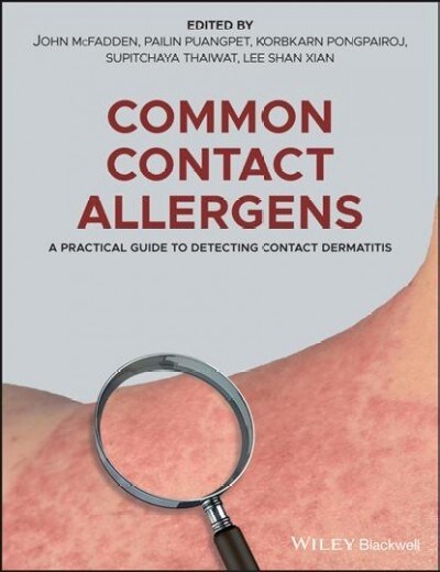 Common Contact Allergens: A Practical Guide to Detecting Contact Dermatitis (Hardcover)