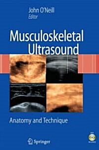 Musculoskeletal Ultrasound: Anatomy and Technique [With DVD] (Hardcover, 2008)