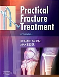 Practical Fracture Treatment (Paperback, 5 ed)