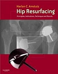 Hip Resurfacing (Hardcover, 1st)