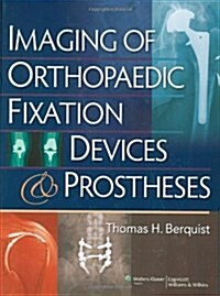 Imaging of Orthopaedic Fixation Devices and Prostheses (Hardcover)