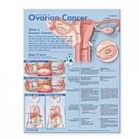 Understanding Ovarian Cancer Anatomical Chart + Anatomy of the Brain Chart (Chart)