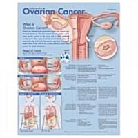 Understanding Ovarian Cancer Anatomical Chart (Hardcover)