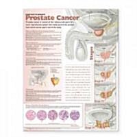 Understanding Prostate Cancer Anatomical Chart (Chart, 1st, Wall)