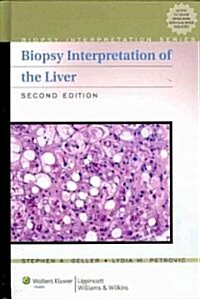 Biopsy Interpretation of the Liver (Hardcover, 2)