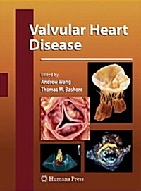 Valvular Heart Disease (Paperback, 2009)