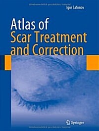 Atlas of Scar Treatment and Correction (Hardcover, 2013)
