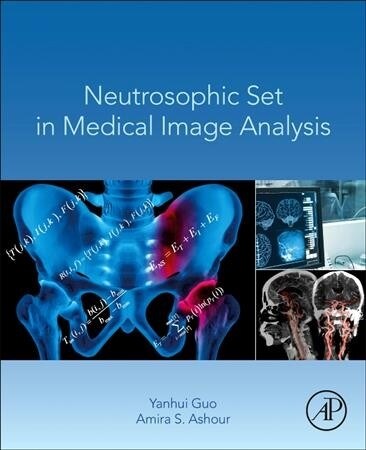 Neutrosophic Set in Medical Image Analysis (Paperback)