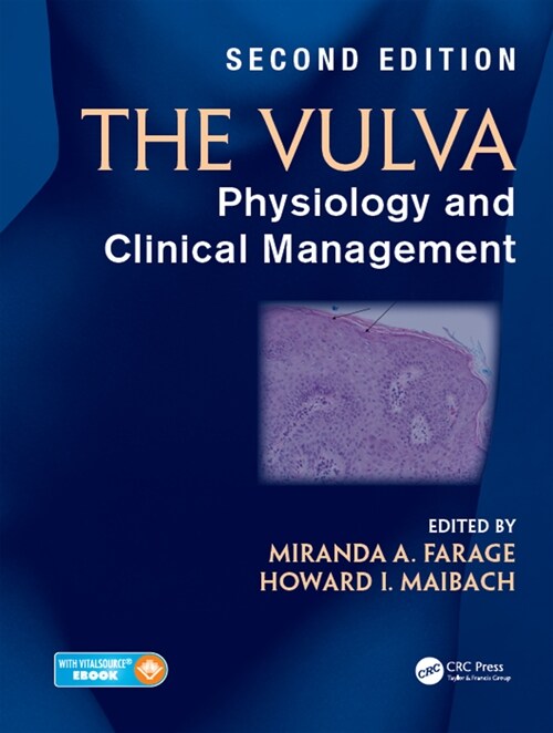 The Vulva (DG, 2)