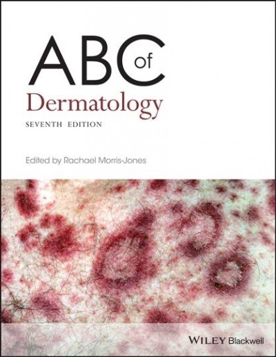 ABC OF DERMATOLOGY (Paperback)