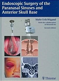 Endoscopic Surgery of the Paranasal Sinuses and Anterior Skull Base (Hardcover, 2)