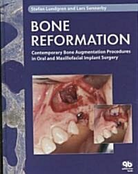 Bone Reformation: Contemporary Bone Augmentation Procedures in Oral and Maxillofacial Implant Surgery                                                  (Hardcover)