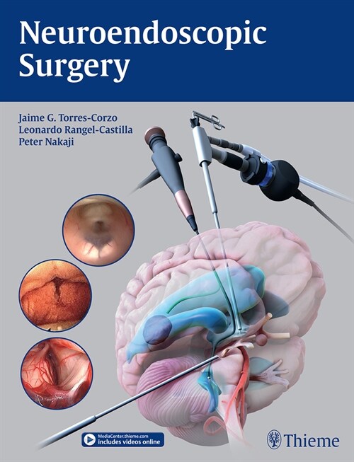 Neuroendoscopic Surgery (Hardcover)