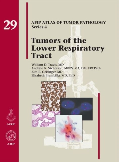 Tumors of the Lower Respiratory Tract (Hardcover)