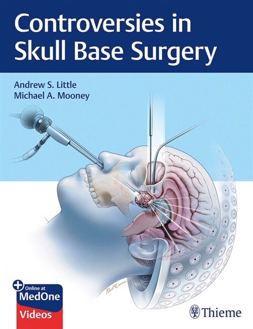 Controversies in Skull Base Surgery (Hardcover)
