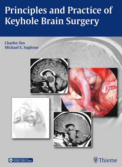 Principles and Practice of Keyhole Brain Surgery (Hardcover)