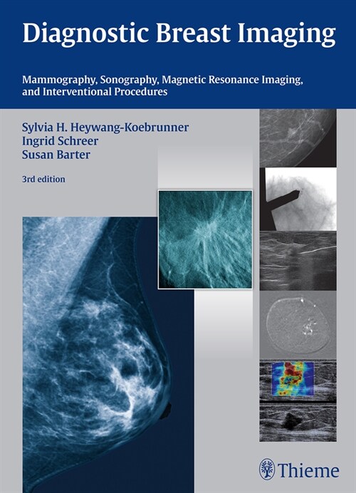 Diagnostic Breast Imaging: Mammography, Sonography, MRI and Interventional Procedures (Hardcover, 3)