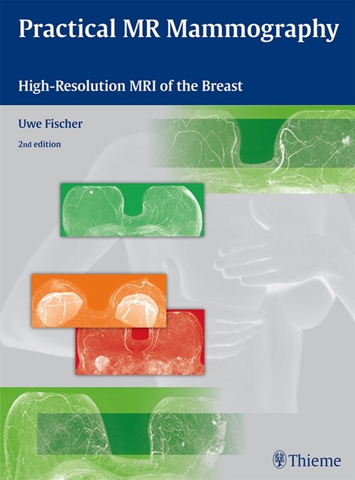 Practical MR Mammography: High-Resolution MRI of the Breast (Hardcover, 2)