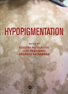 Hypopigmentation (Hardcover)