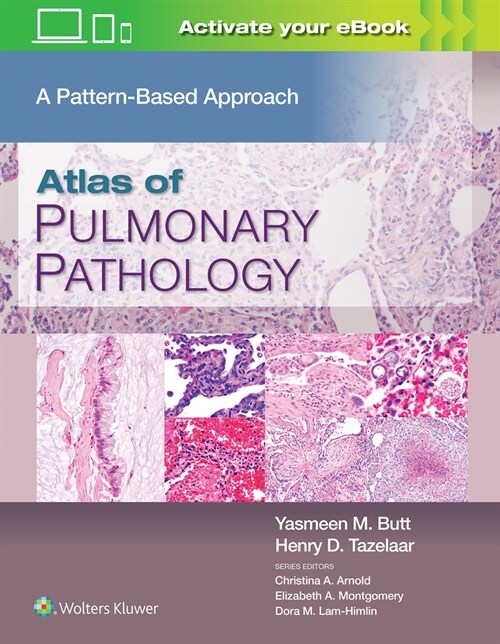 Atlas of Pulmonary Pathology: A Pattern Based Approach (Hardcover)